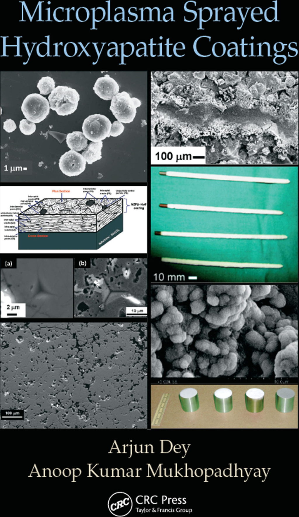 Microplasma Sprayed Hydroxyapatite Coatings 1st Edition