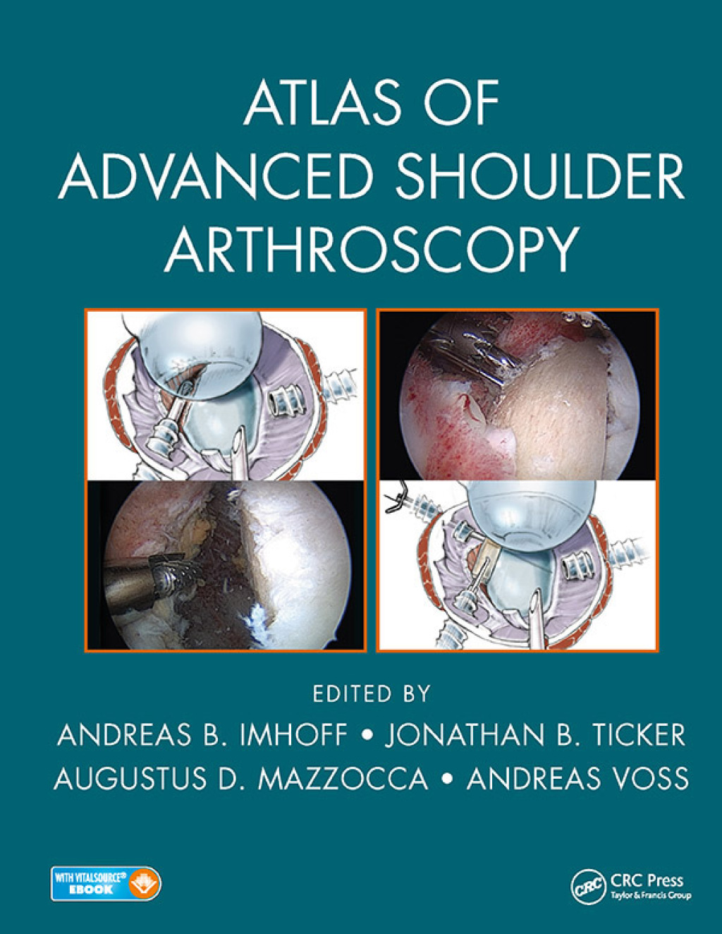 Atlas of Advanced Shoulder Arthroscopy 1st Edition