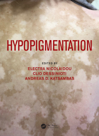 Cover image: Hypopigmentation 1st edition 9781032748849
