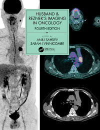 Imagen de portada: Husband & Reznek's Imaging in Oncology 4th edition 9781138301238