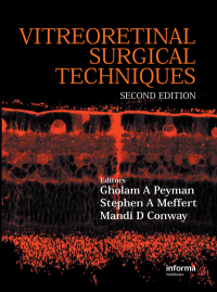 Imagen de portada: Vitreoretinal Surgical Techniques, Second Edition 2nd edition 9781841846262