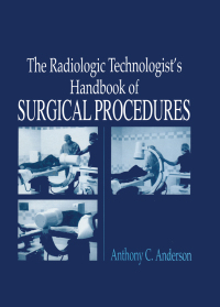 表紙画像: The Radiology Technologist's Handbook to Surgical Procedures 1st edition 9780849315060