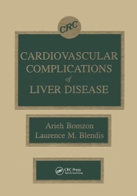 Immagine di copertina: Cardiovascular Complications of Liver Disease 1st edition 9780849347351