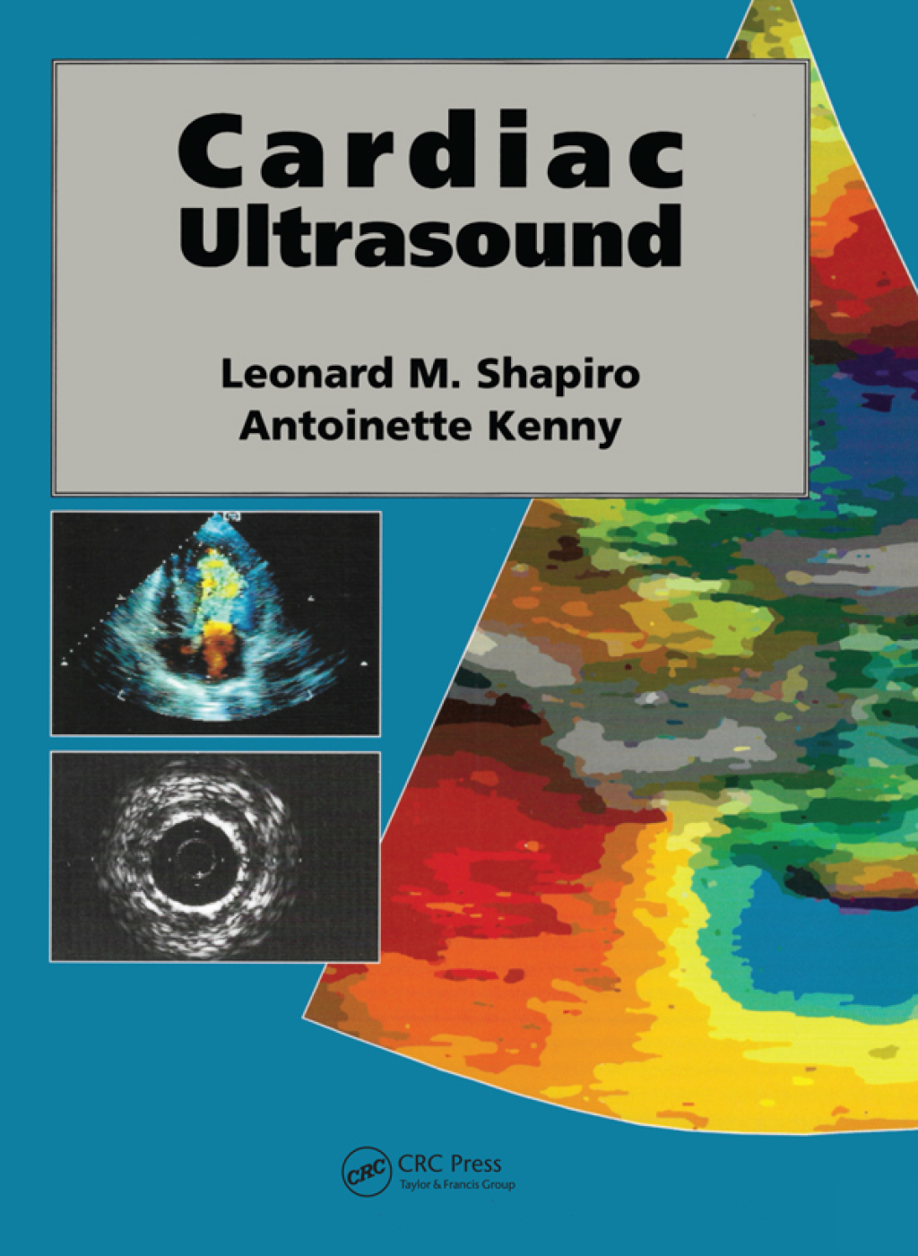 Cardiac Ultrasound 1st Edition