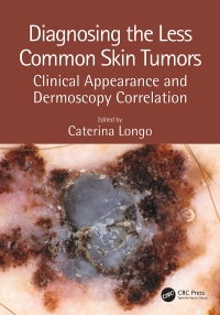 Cover image: Diagnosing the Less Common Skin Tumors 1st edition 9781138106628