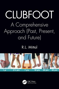 Cover image: Clubfoot 1st edition 9780367656010