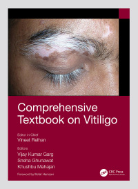 Cover image: Comprehensive Textbook on Vitiligo 1st edition 9780367543723