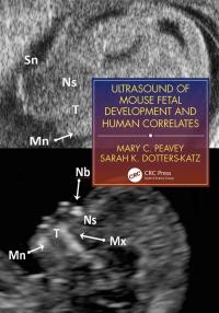 صورة الغلاف: Ultrasound of Mouse Fetal Development and Human Correlates 1st edition 9781138071216