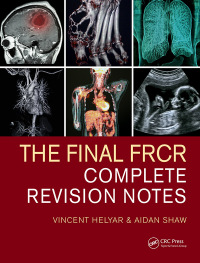 Cover image: The Final FRCR 1st edition 9780367484736