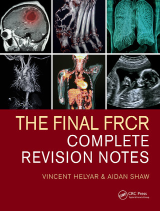 表紙画像: The Final FRCR 1st edition 9780367484736