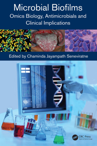 Titelbild: Microbial Biofilms 1st edition 9780367657994