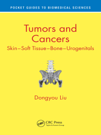 صورة الغلاف: Tumors and Cancers 1st edition 9781138300811