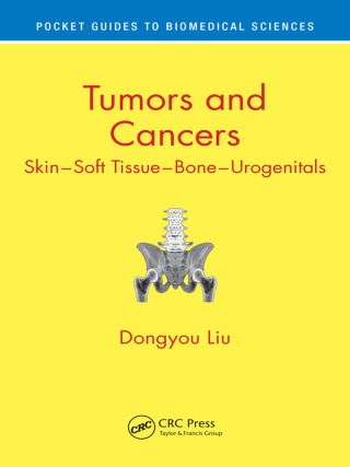 Imagen de portada: Tumors and Cancers 1st edition 9781138300811