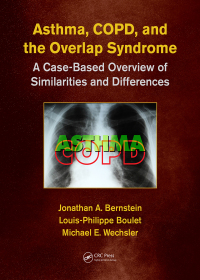 Cover image: Asthma, COPD, and Overlap 1st edition 9781498758413