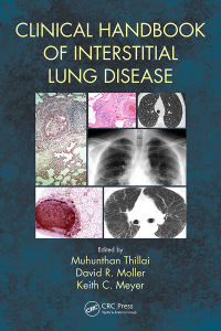 Imagen de portada: Clinical Handbook of Interstitial Lung Disease 1st edition 9781498768252
