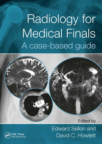 Cover image: Radiology for Medical Finals 1st edition 9781138088740