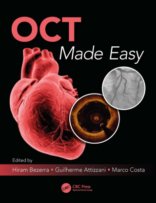 Immagine di copertina: OCT Made Easy 1st edition 9781138056770