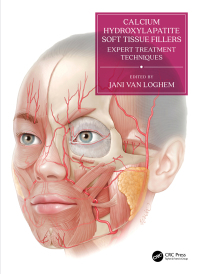 表紙画像: Calcium Hydroxylapatite Soft Tissue Fillers 1st edition 9780367530150