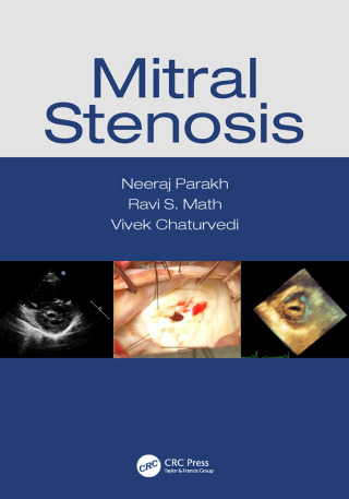 Cover image: Mitral Stenosis 1st edition 9781032520506