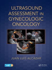 صورة الغلاف: Ultrasound Assessment in Gynecologic Oncology 1st edition 9781138044326