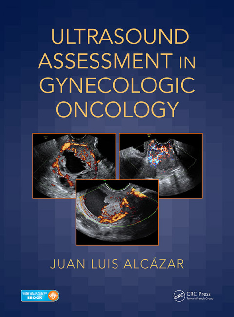 Ultrasound Assessment in Gynecologic Oncology, 1st Edition - FULL INSTANT DOWNLOAD | PDF DOCX EPUB