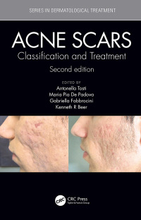 Cover image: Acne Scars 2nd edition 9781138894228