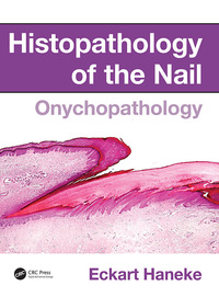 表紙画像: Histopathology of the Nail 1st edition 9781482212327