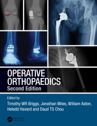 Cover image: Operative Orthopaedics 2nd edition 9781138031760