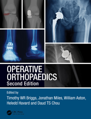 Imagen de portada: Operative Orthopaedics 2nd edition 9781138031760