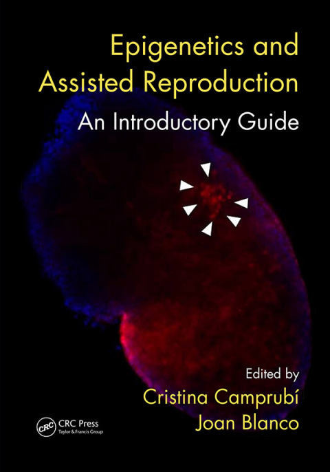 Epigenetics and Assisted Reproduction: An Introductory Guide, 1st Edition - FULL INSTANT DOWNLOAD | PDF DOCX EPUB