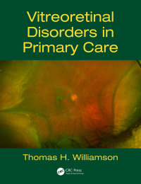 Imagen de portada: Vitreoretinal Disorders in Primary Care 1st edition 9781138096547