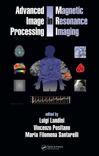 Titelbild: Advanced Image Processing in Magnetic Resonance Imaging 1st edition 9780824725426