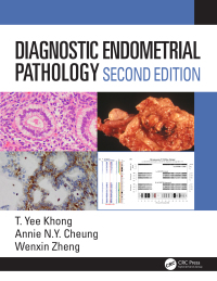Cover image: Diagnostic Endometrial Pathology 2E 2nd edition 9781138626416