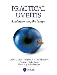 Cover image: Practical Uveitis 1st edition 9781138303690