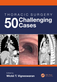 Cover image: Thoracic Surgery: 50 Challenging cases 1st edition 9780367408329