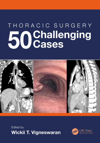 Cover image: Thoracic Surgery: 50 Challenging cases 1st edition 9781032981277