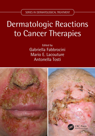 Cover image: Dermatologic Reactions to Cancer Therapies 1st edition 9781032783536