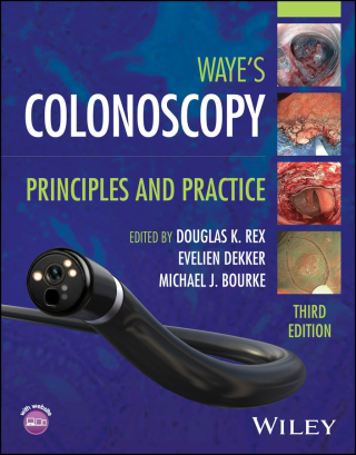 Cover image: Colonoscopy 3rd edition 9781394220250