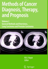 صورة الغلاف: Methods of Cancer Diagnosis, Therapy and Prognosis 1st edition 9781402084416