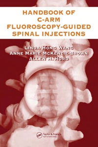 Imagen de portada: The Handbook of C-Arm Fluoroscopy-Guided Spinal Injections 1st edition 9780849322549