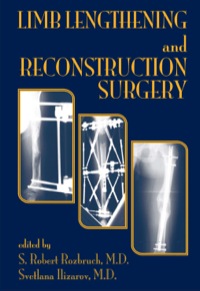 Imagen de portada: Limb Lengthening and Reconstruction Surgery 1st edition 9780849340512