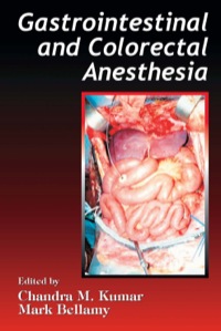Cover image: Gastrointestinal and Colorectal Anesthesia 1st edition 9780849340734