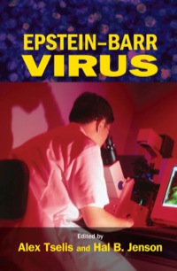 Imagen de portada: Epstein-Barr Virus 1st edition 9780367391065