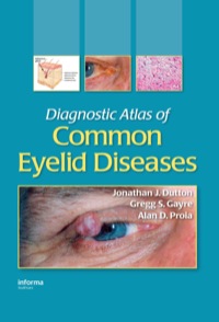 صورة الغلاف: Diagnostic Atlas of Common Eyelid Diseases 1st edition 9780824728397