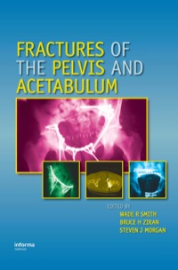 Cover image: Fractures of the Pelvis and Acetabulum 1st edition 9780824728465