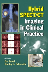 Imagen de portada: Hybrid SPECT/CT Imaging in Clinical Practice 1st edition 9780824728540