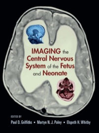 Imagen de portada: Imaging the Central Nervous System of the Fetus and Neonate 1st edition 9780824728564