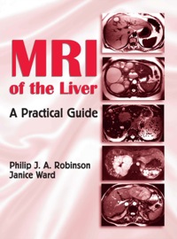 Cover image: MRI of the Liver 1st edition 9780824728717