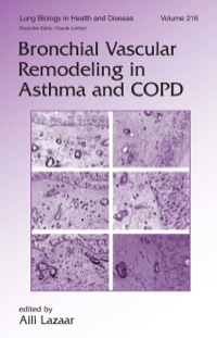 表紙画像: Bronchial Vascular Remodeling in Asthma and COPD 1st edition 9780824729813