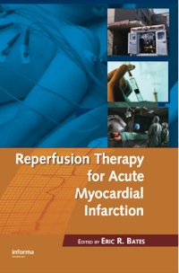 Imagen de portada: Reperfusion Therapy for Acute Myocardial Infarction 1st edition 9780849343582